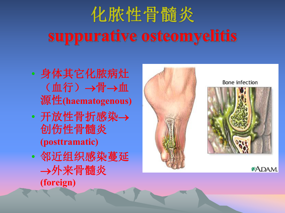 最全十大名校外科学6课件.ppt_第2页