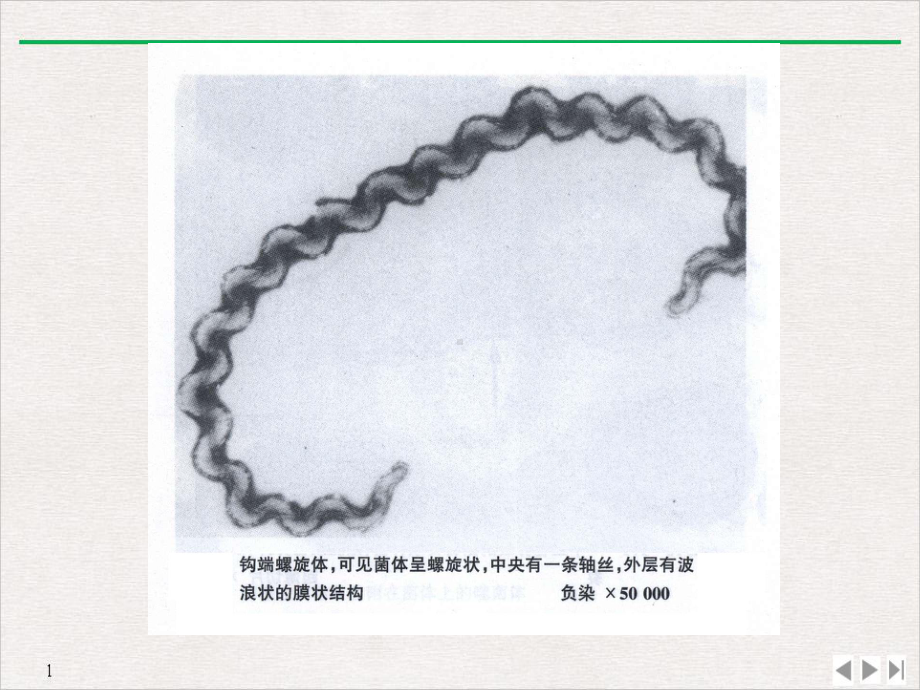 钩端螺旋体病全科医学实用版课件.ppt_第2页