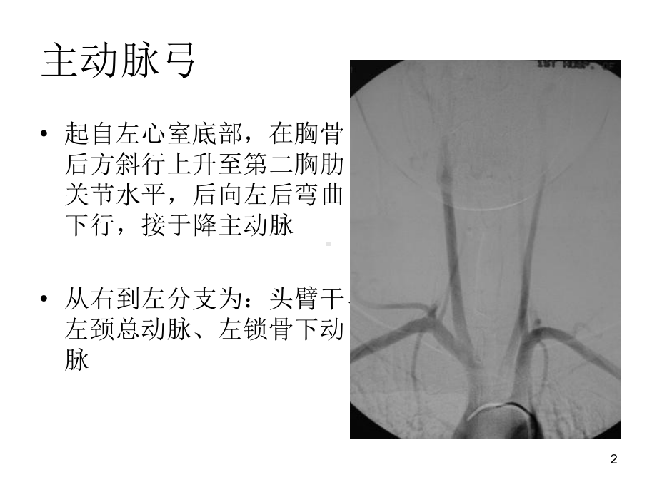 脑血管的正常变异及异常参考课件.ppt_第2页