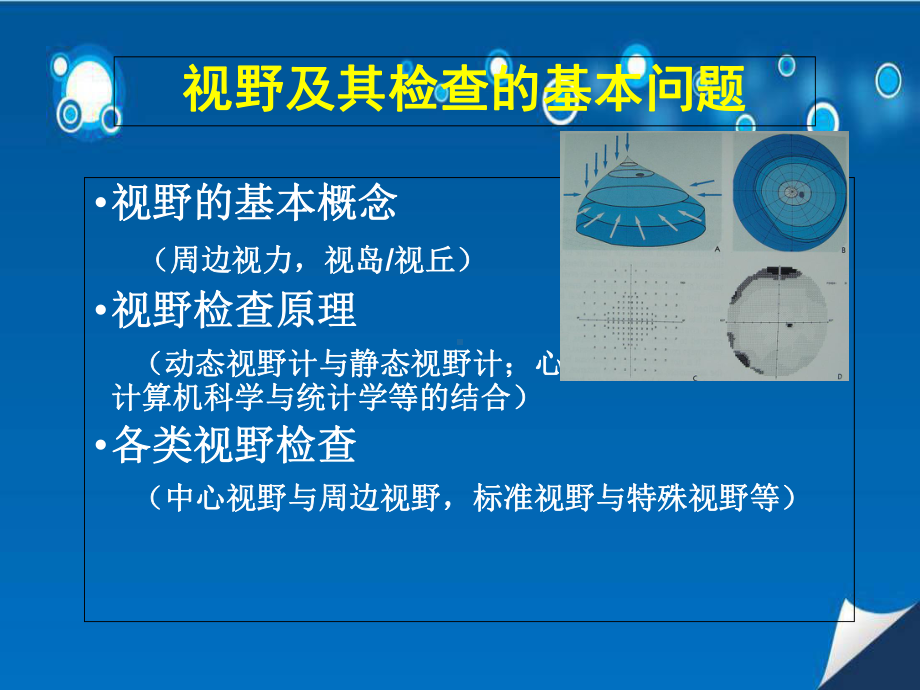 视野检查在青光眼诊治过程中的合理应用医学课件.ppt_第3页