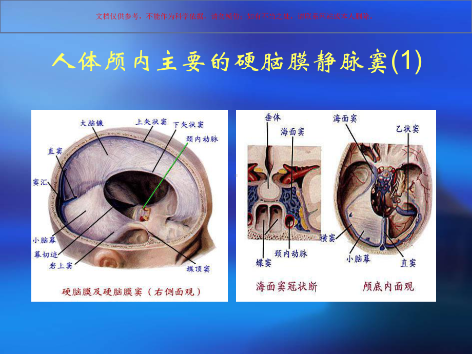 颅内静脉窦损伤课件.ppt_第3页