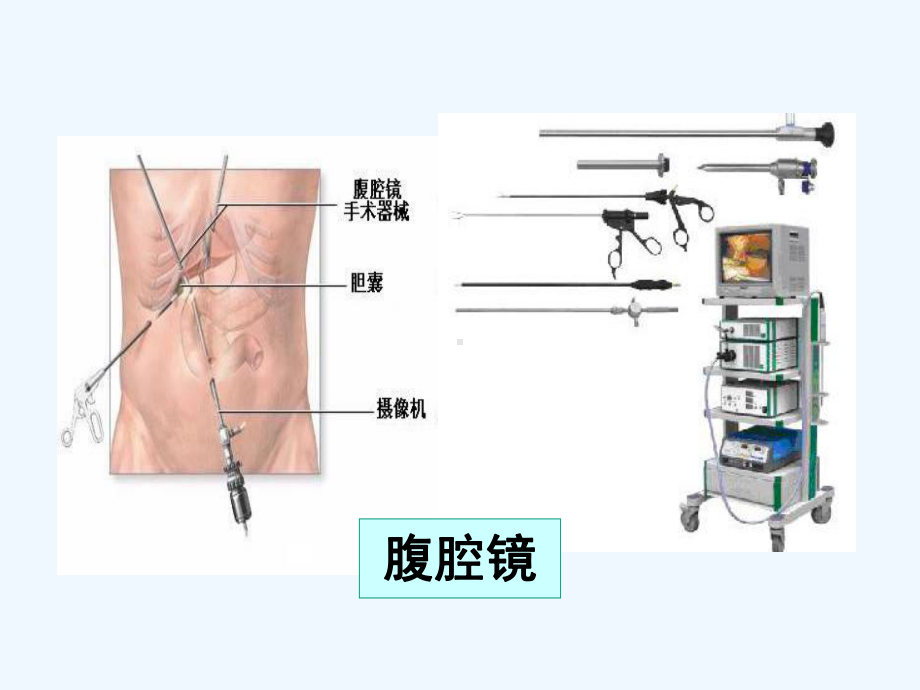 腹腔镜在小儿外科中的应用课件.ppt_第3页