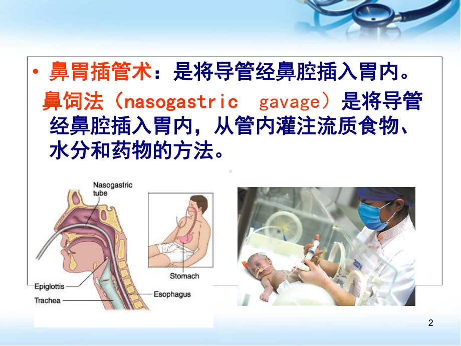 小儿胃管置入术医学课件.ppt_第2页