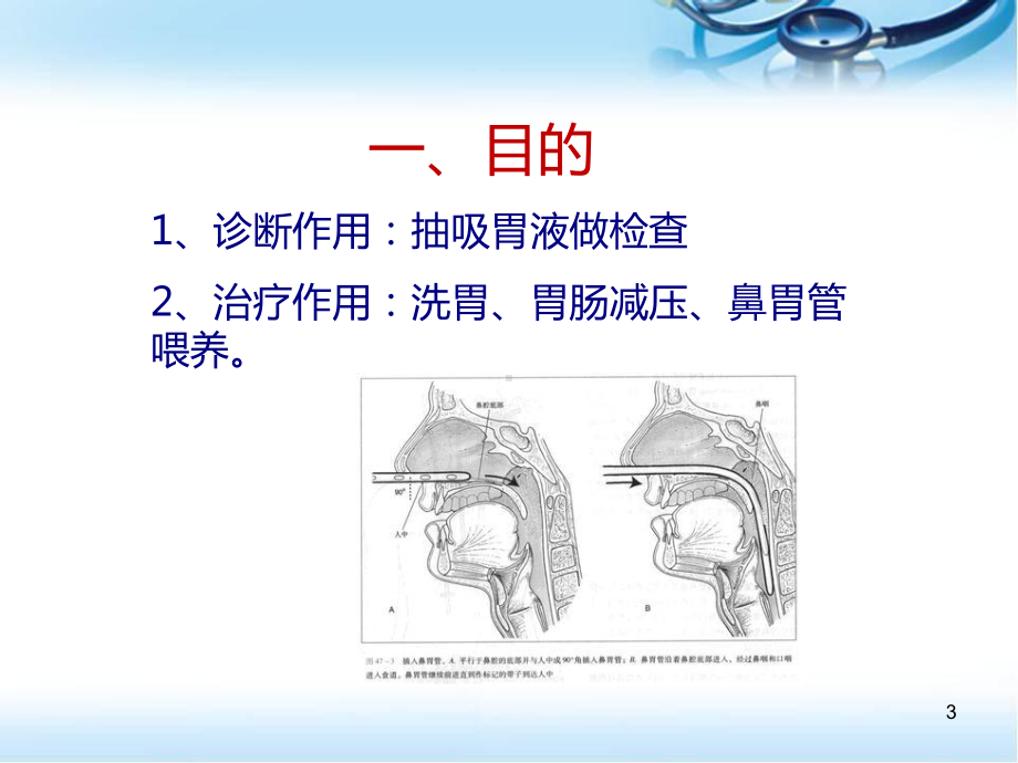 小儿胃管置入术医学课件.ppt_第3页