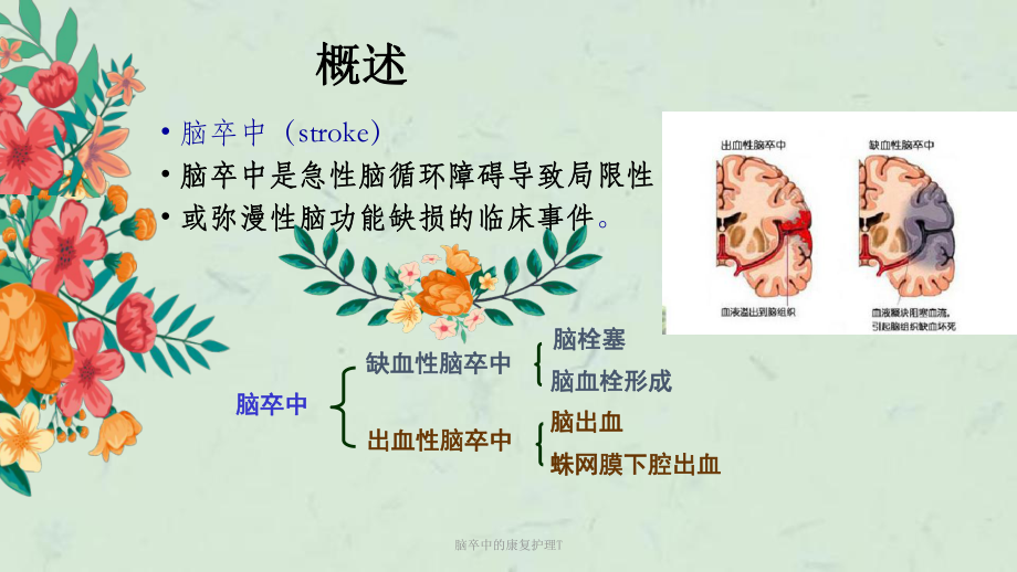 脑卒中的康复护理T课件.ppt_第2页