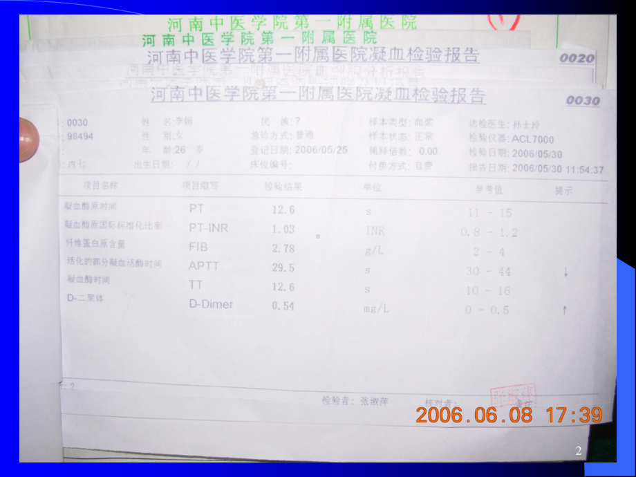 贫血一般检查课件-2.ppt_第2页