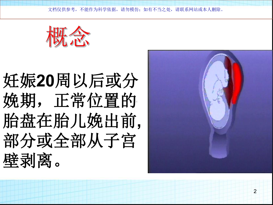 胎盘早剥的医疗护理课件.ppt_第2页