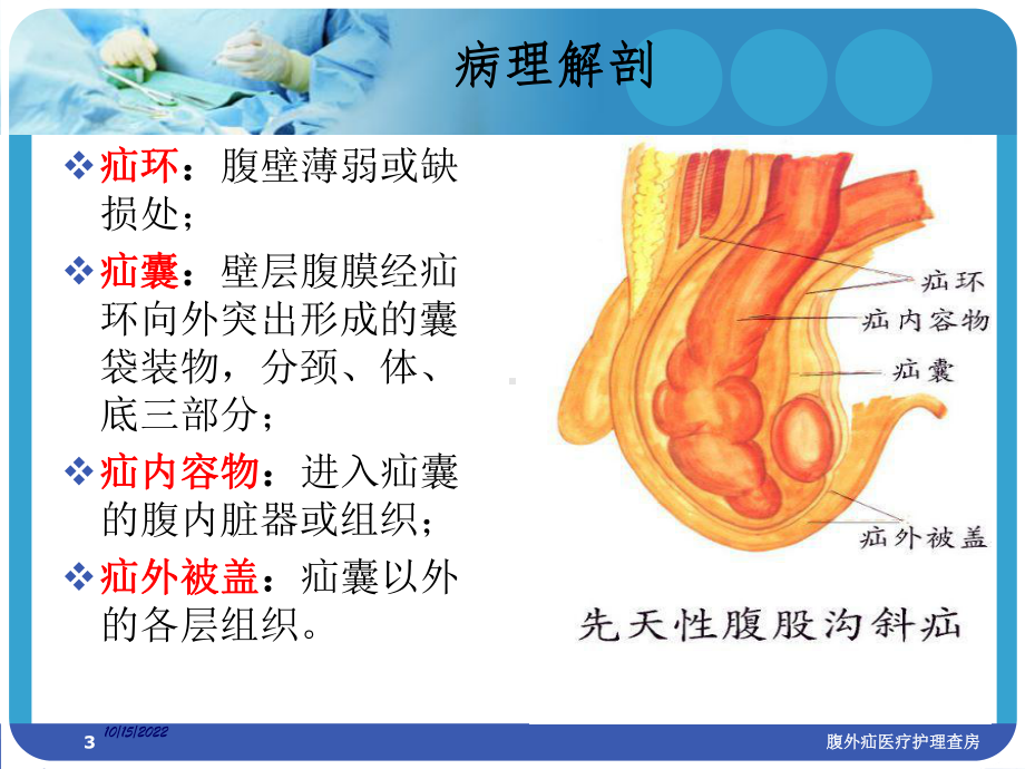 腹外疝医疗护理查房培训课件.ppt_第3页