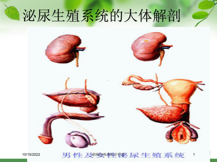 膀胱冲洗的医疗护理培训课件.ppt_第1页