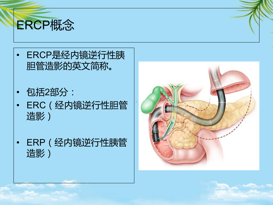 胆总管结石ERCP术围手术期护理课件.ppt_第3页