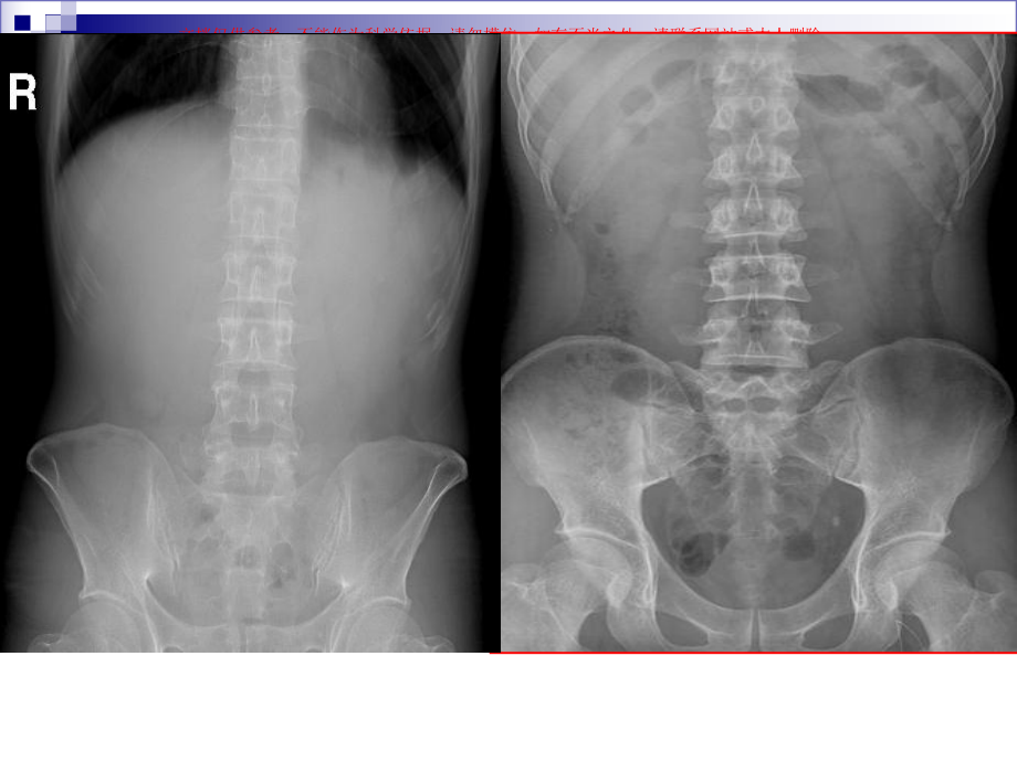 腹部盆腔泌尿乳腺读片培训课件.ppt_第1页