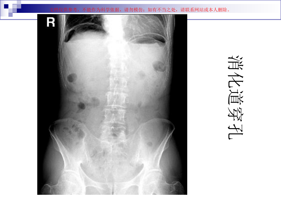 腹部盆腔泌尿乳腺读片培训课件.ppt_第2页