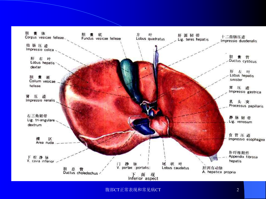 腹部CT正常表现和常见病CT培训课件.ppt_第2页