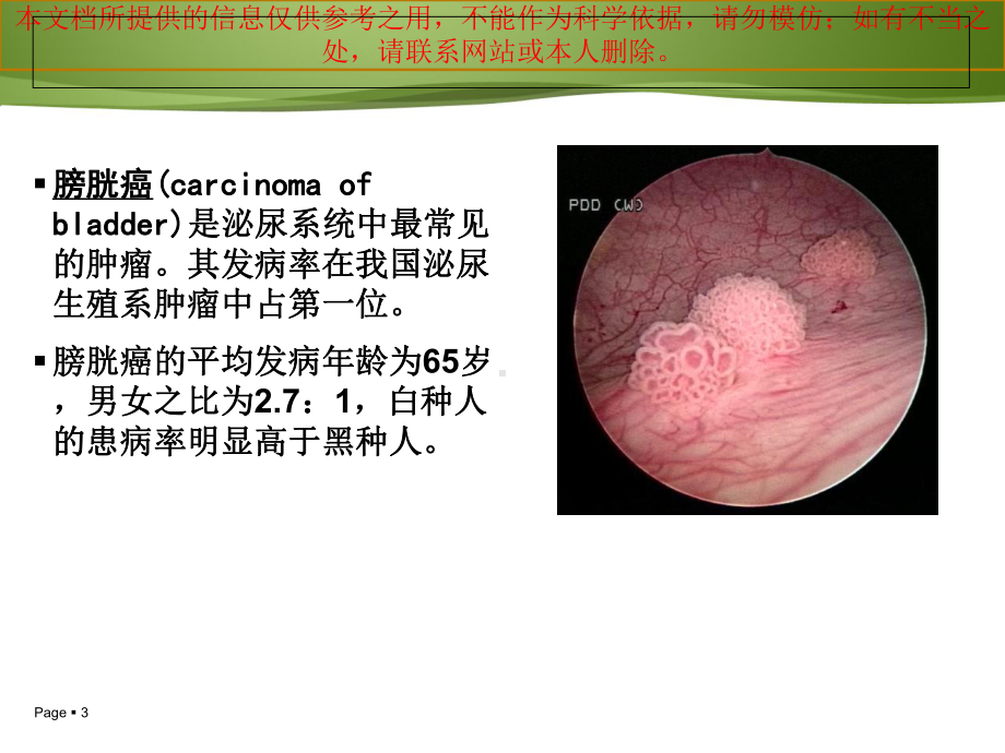 膀胱癌病人的医疗护理和健康教育培训课件.ppt_第3页