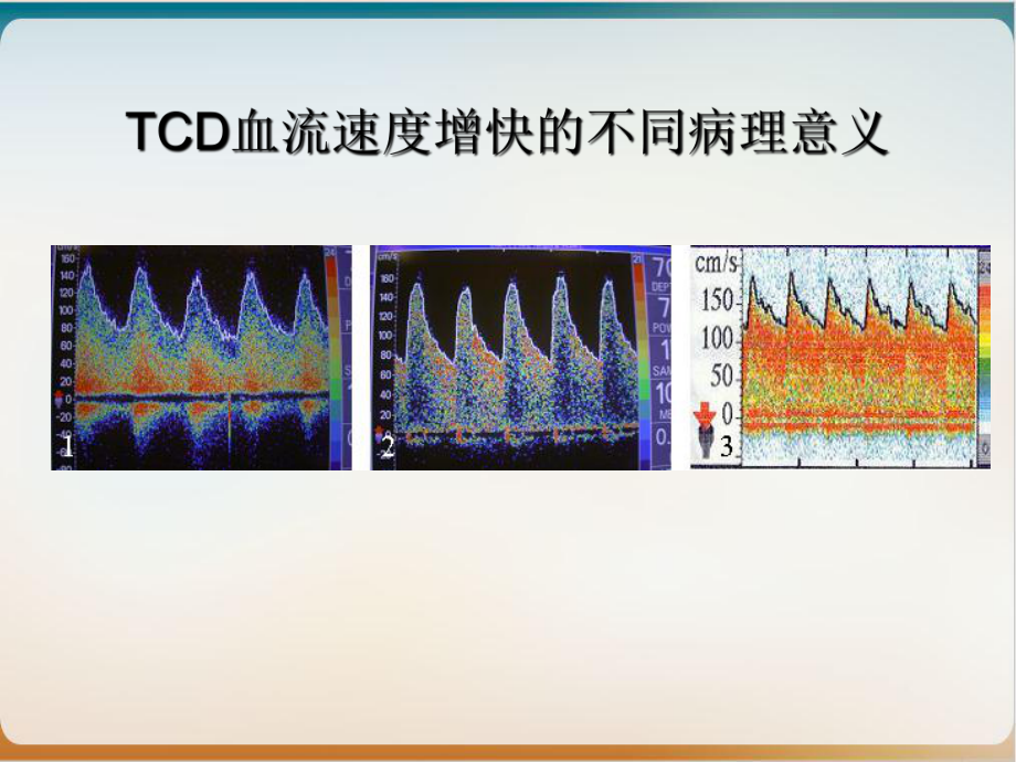 血管流速快慢的意义示范课件.ppt_第3页