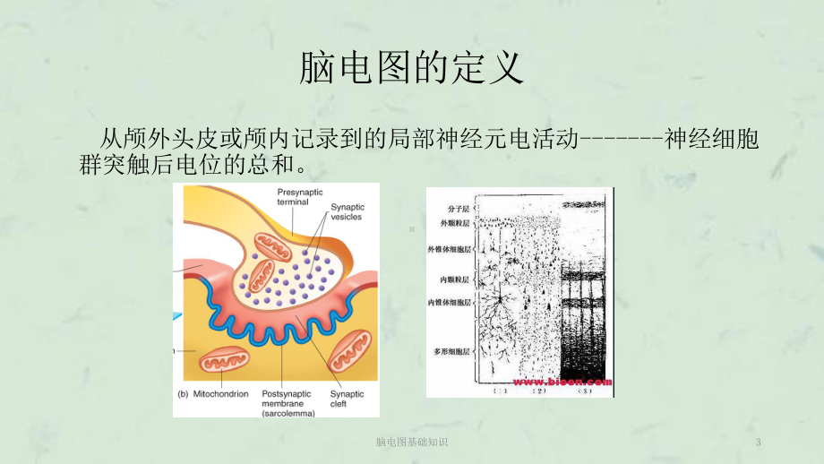 脑电图基础知识课件.ppt_第3页