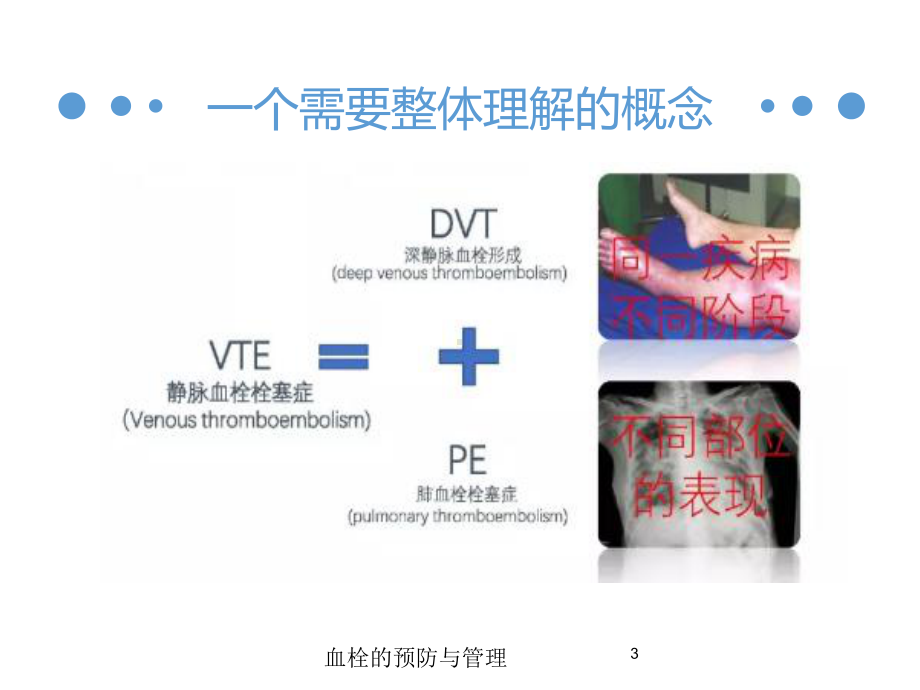 血栓的预防与管理培训课件.ppt_第3页