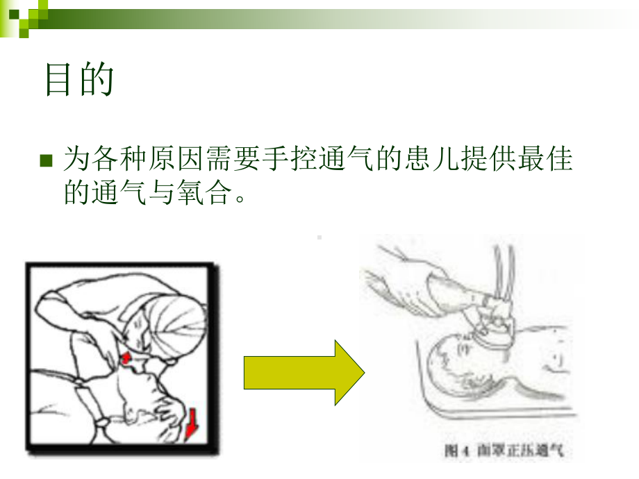 自动充气型复苏气课件.ppt_第2页