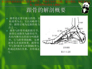 跟骨骨折术后医疗护理培训课件.ppt