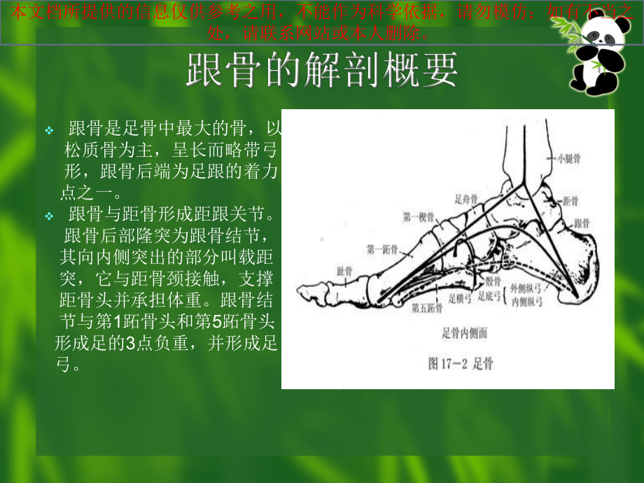 跟骨骨折术后医疗护理培训课件.ppt_第1页