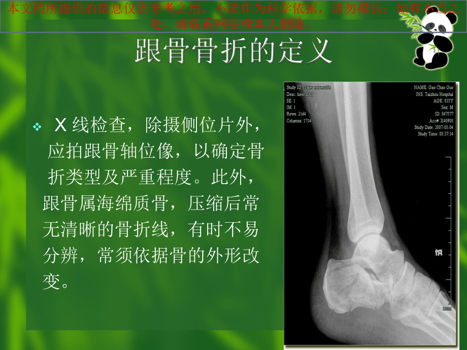 跟骨骨折术后医疗护理培训课件.ppt_第3页