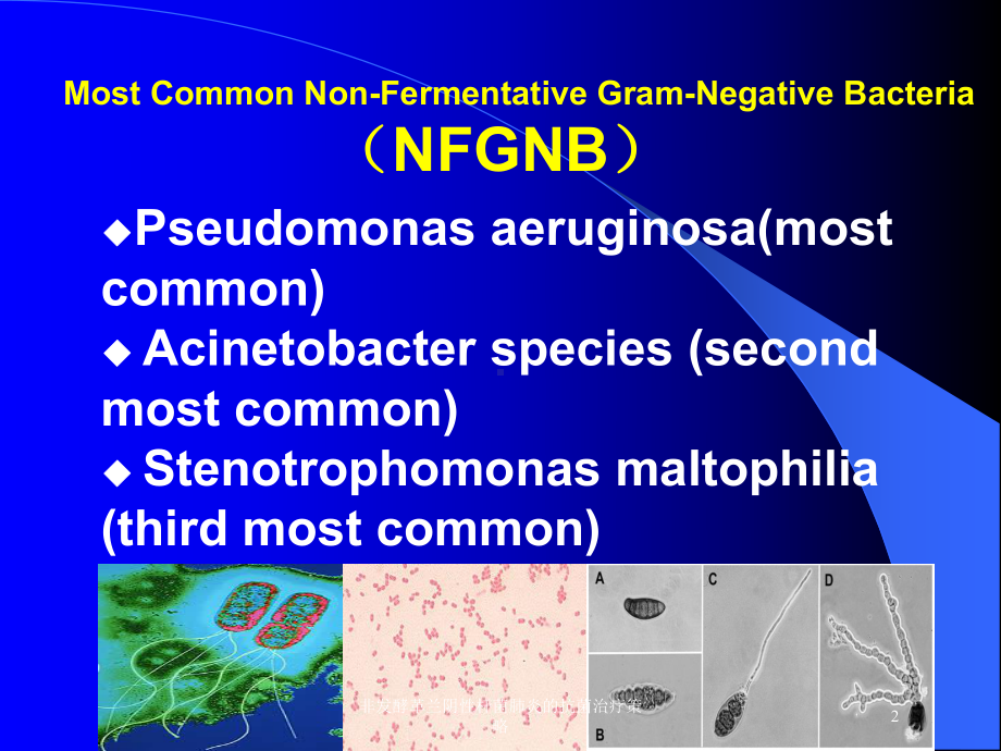 非发酵革兰阴性杆菌肺炎的抗菌治疗策略培训课件.ppt_第2页