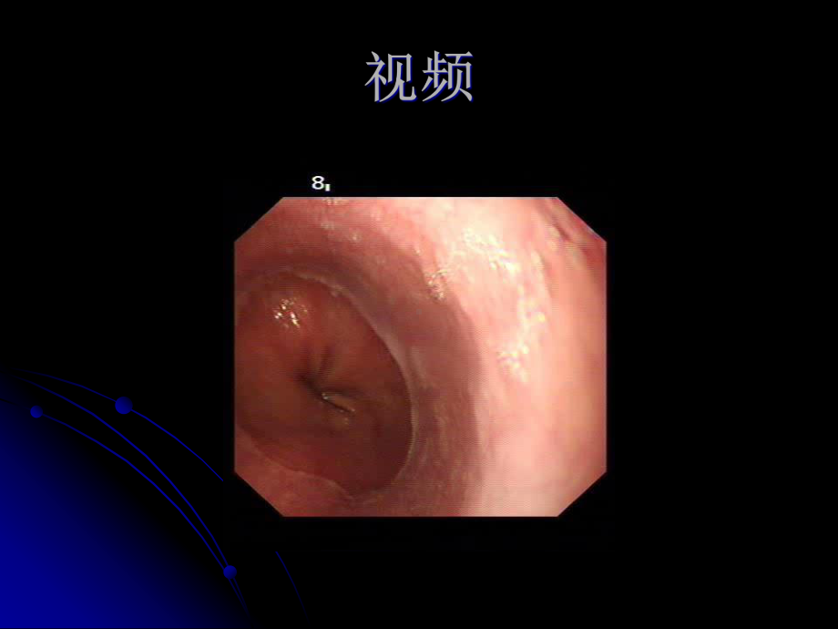 胃十二指肠疾病的内窥镜诊断课件.pptx_第2页