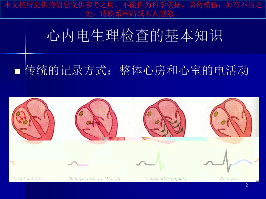 阵发性室上性心动过速培训课件.ppt_第2页