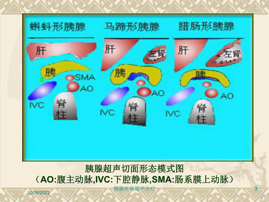 胰腺疾病超声诊疗培训课件.ppt_第3页