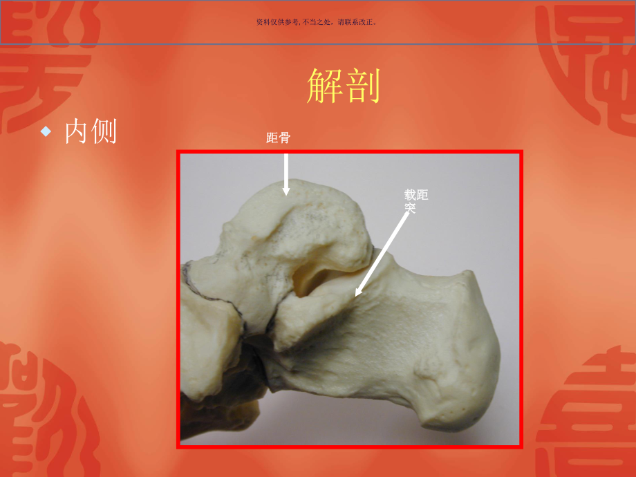 跟骨骨折的分型和治疗课件.ppt_第3页