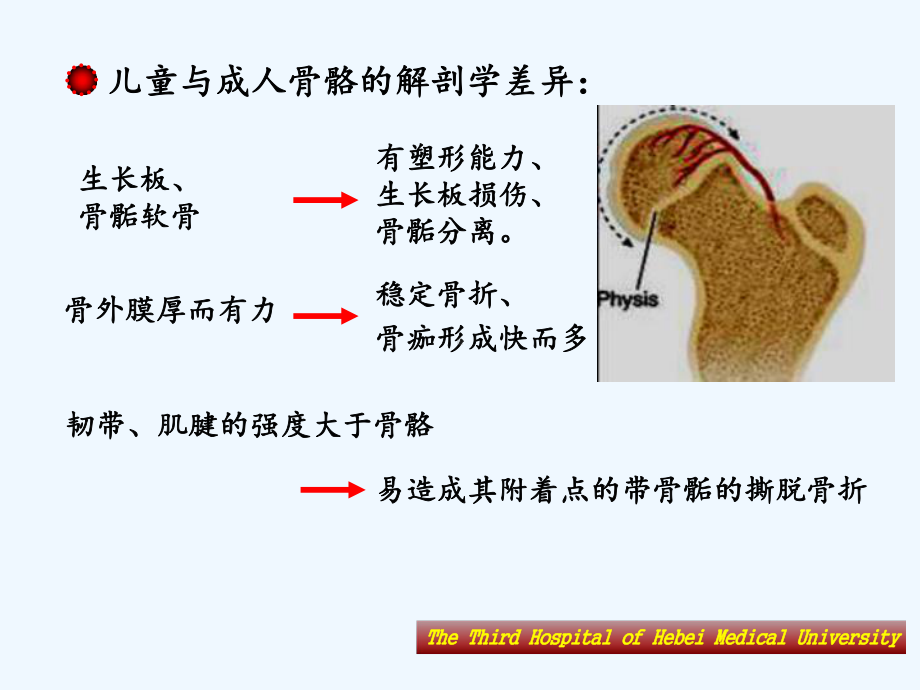 规培骨折特点与骨骺损伤儿童课件.ppt_第2页