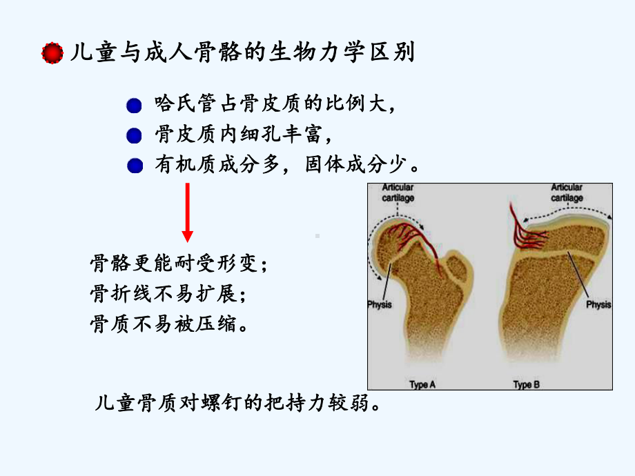 规培骨折特点与骨骺损伤儿童课件.ppt_第3页