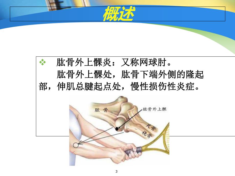 针刀治疗肱骨外上髁炎思路探讨教学课件.ppt_第3页