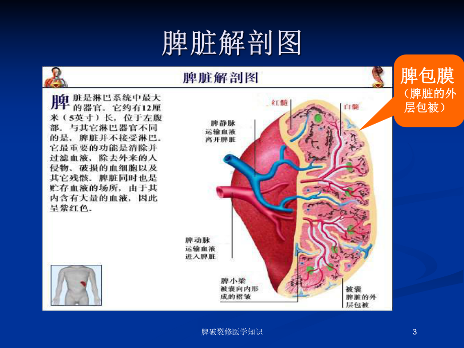 脾破裂修医学知识培训课件.ppt_第3页