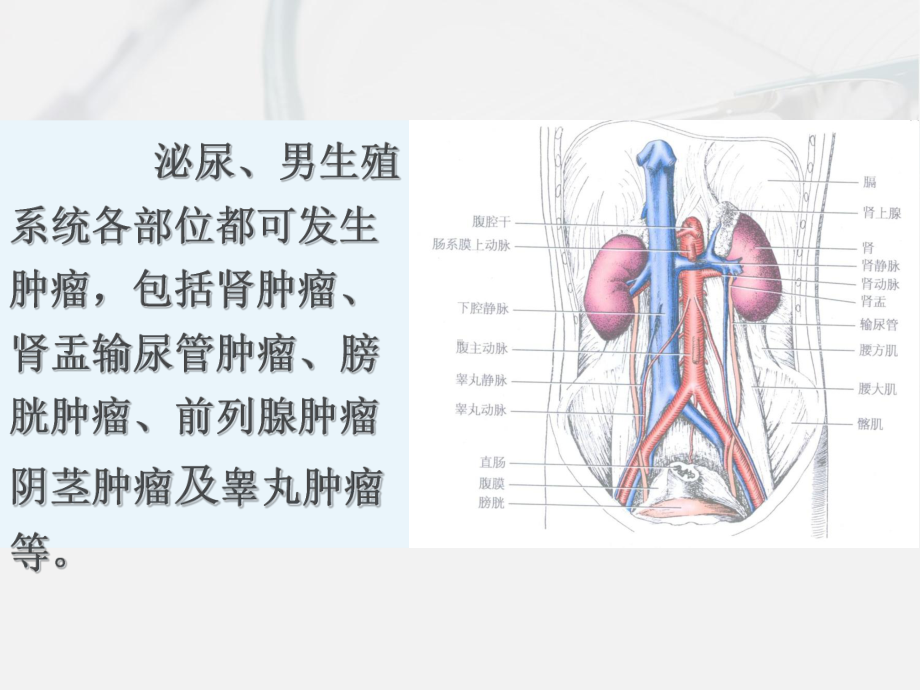 泌尿系统梗阻结石及肿瘤课件.pptx_第2页