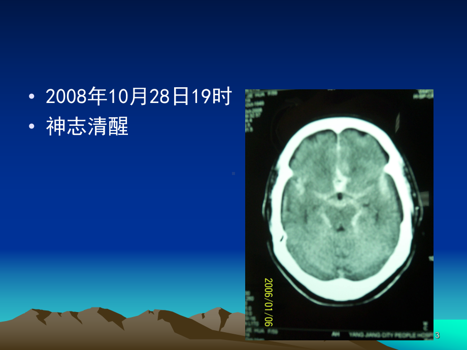 蛛网膜下腔出血诊断与治疗课件.ppt_第3页