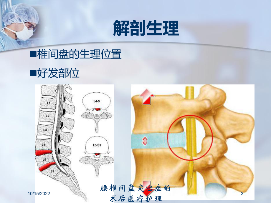 腰椎间盘突出症的术后医疗护理培训课件.ppt_第3页