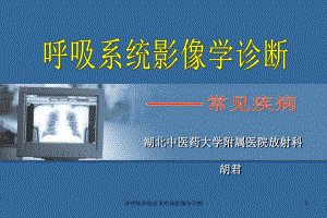 讲呼吸系统常见疾病影像学诊断课件.ppt