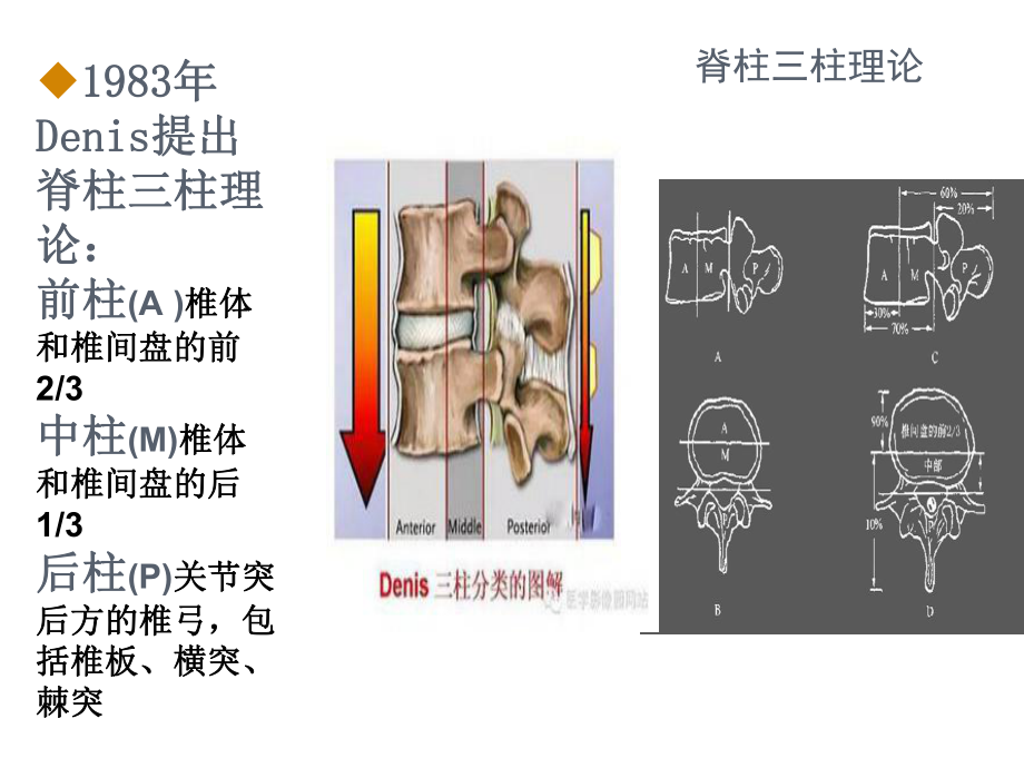 腰椎间盘突出症的临床分型与治疗学习课件.ppt_第3页