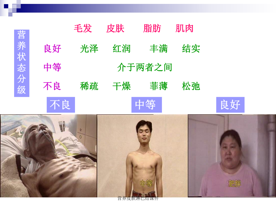 营养皮肤淋巴结课件.ppt_第3页