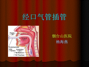 气管插管技术课件.ppt