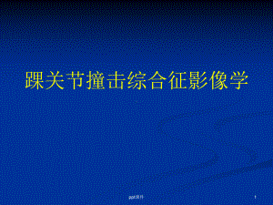 踝关节撞击综合征影像学-课件.ppt