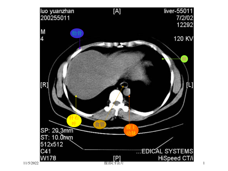 腹部CT读片培训课件.ppt_第1页