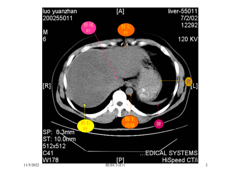 腹部CT读片培训课件.ppt_第2页
