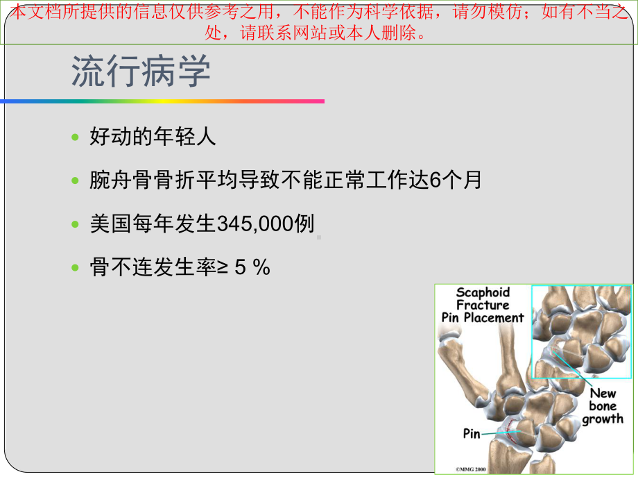 腕舟骨骨折专业知识讲座培训课件.ppt_第2页