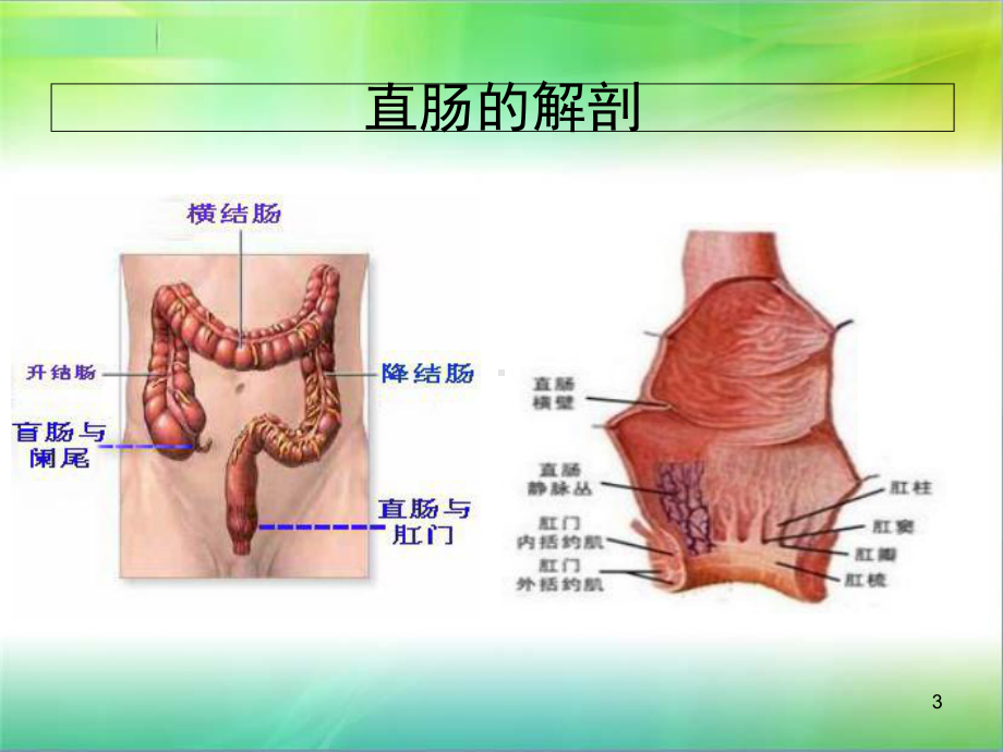 直肠癌病例讨论医学课件.ppt_第3页