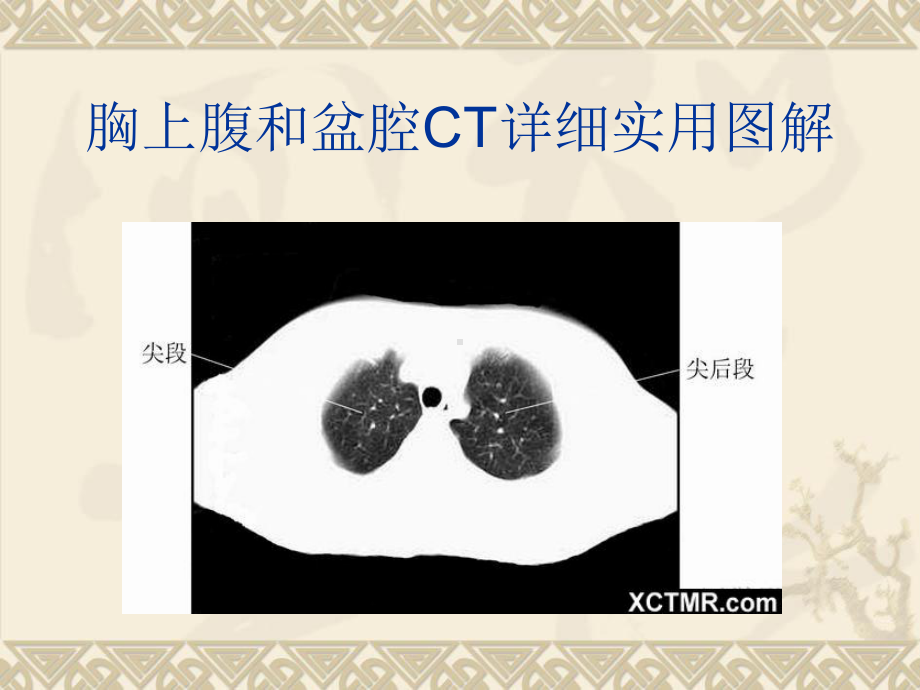 胸上腹和盆腔CT详细实用图解-课件.ppt_第3页