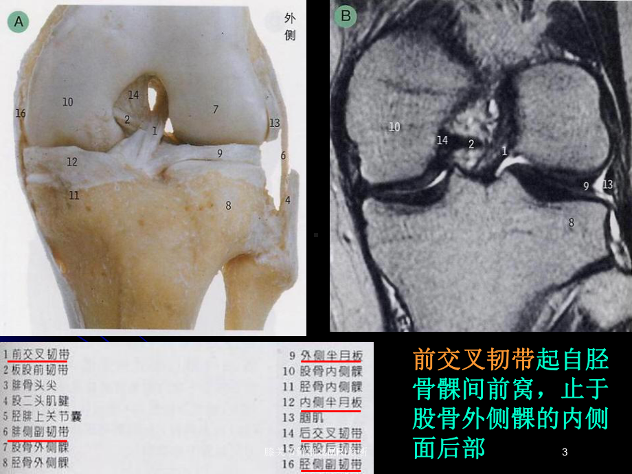 膝关节解剖及MRI诊断培训课件.ppt_第3页