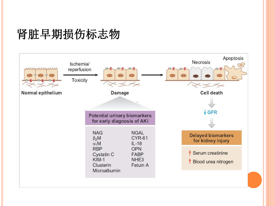 肾损伤早期标志物培训课件.ppt_第3页