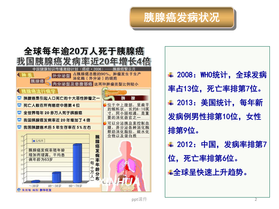 胰腺癌诊治指南-课件.ppt_第2页